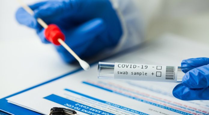 Amazon launches two day PCR tests